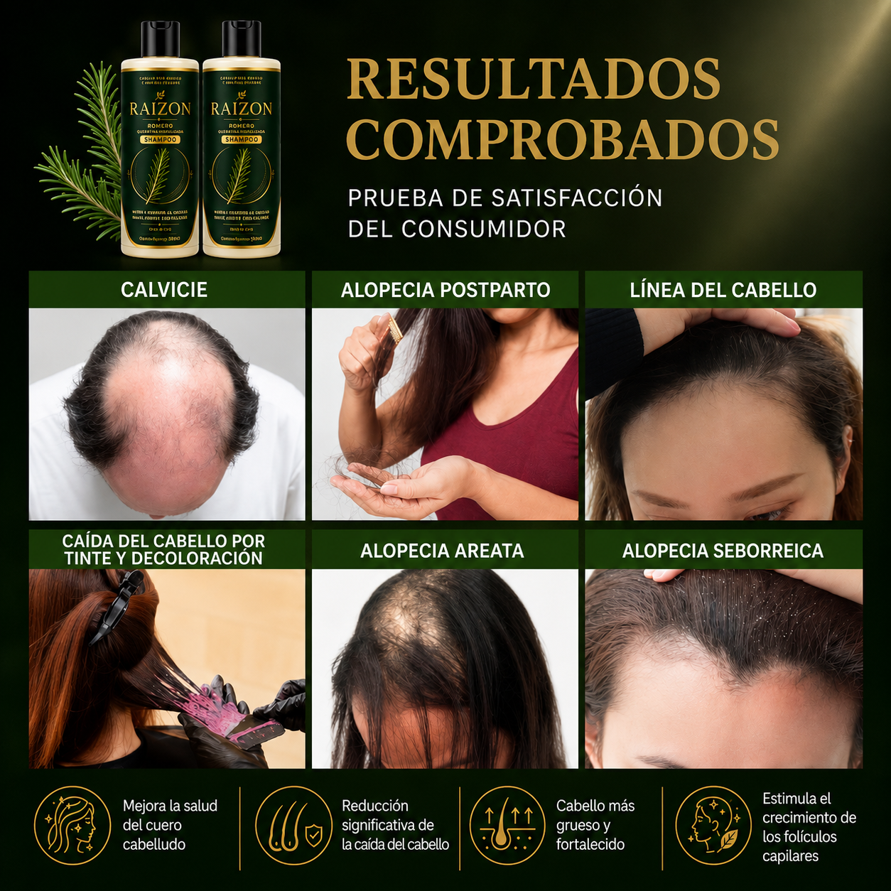 RAIZON™ Shampoo Anticaída y Crecimiento