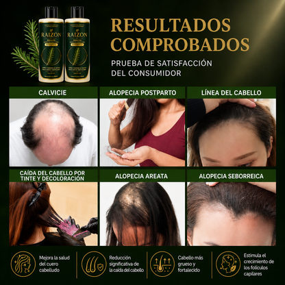 RAIZON™ Shampoo Anticaída y Crecimiento