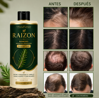 RAIZON™ Shampoo Anticaída y Crecimiento