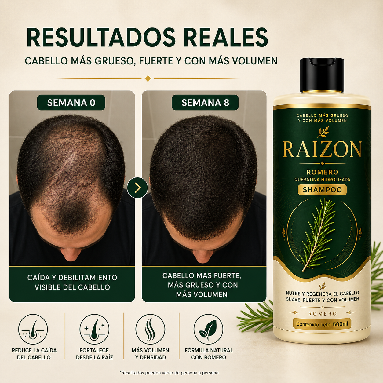 RAIZON™ Shampoo Anticaída y Crecimiento