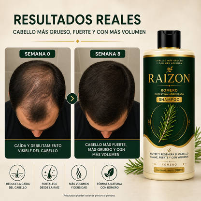 RAIZON™ Shampoo Anticaída y Crecimiento